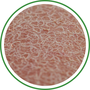 Dry Skin