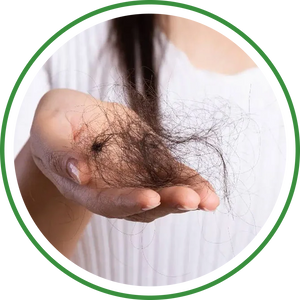 Hair Fall